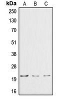 CPA1291-100ul - Cardiotrophin-1
