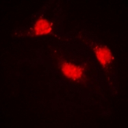 CPA1293-100ul - Catenin beta-1