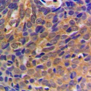 CPA1294-100ul - Catenin beta-1
