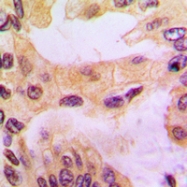 CPA1297-100ul - Cathepsin D