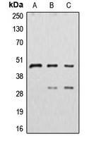 CPA1297-100ul - Cathepsin D