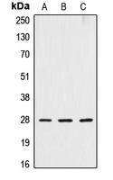 CPA1298-100ul - Cathepsin D