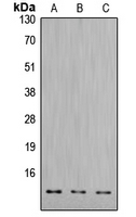 CPA1299-100ul - Cathepsin D