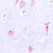CPA1300-100ul - Cathepsin E