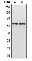 CPA1307-100ul - Cytochrome P450 1A1/2
