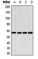 CPA1319-100ul - CYP2E1