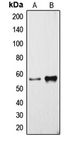 CPA1321-100ul - CYP3A4
