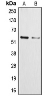 CPA1322-100ul - Cytochrome P450 3A4/5