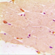 CPA1337-100ul - Desmin