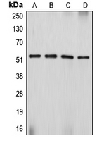 CPA1337-100ul - Desmin