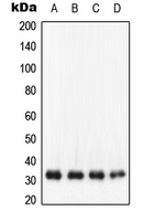CPA1342-100ul - NQO1