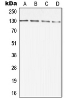 CPA1343-100ul - DIAPH2
