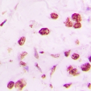 CPA1346-100ul - DLX5