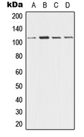 CPA1354-100ul - Desmoglein-3