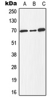 CPA1358-100ul - E2F1