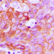 CPA1365-100ul - Ephrin-A1