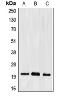 CPA1366-100ul - Ephrin-A2