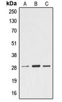 CPA1368-100ul - Ephrin-A4
