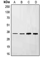 CPA1370-100ul - Ephrin-B3