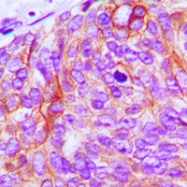 CPA1372-100ul - EGFR / ERBB1