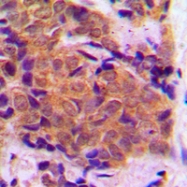 CPA1378-100ul - EIF4E