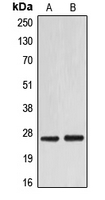 CPA1378-100ul - EIF4E