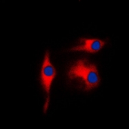 CPA1387-100ul - Neuron specific enolase