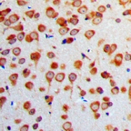CPA1387-100ul - Neuron specific enolase