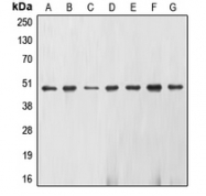 CPA1387-100ul - Neuron specific enolase