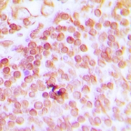 CPA1396-100ul - ERCC1