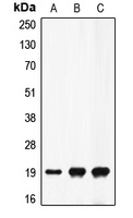 CPA1405-100ul - Prothrombin (F2)
