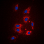 CPA1406-100ul - Thrombin receptor / F2R