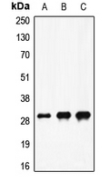 CPA1408-100ul - Coagulation factor X (F10)
