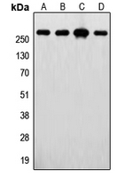 CPA1414-100ul - Fatty acid synthase