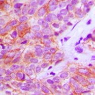 CPA1422-100ul - CD333 / FGFR3