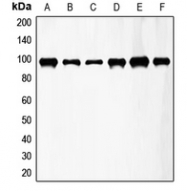 CPA1422-100ul - CD333 / FGFR3