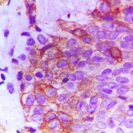 CPA1424-100ul - CD332 / FGFR-2