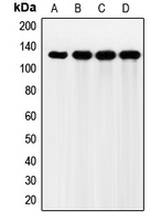 CPA1424-100ul - CD332 / FGFR-2