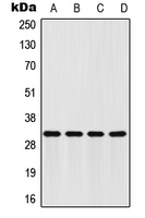 CPA1426-100ul - FHL2 / SLIM3
