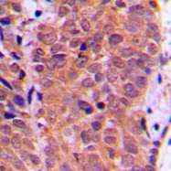 CPA1430-100ul - FOXO1A