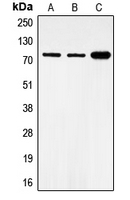 CPA1430-100ul - FOXO1A