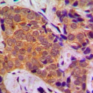 CPA1431-100ul - FOXO1A