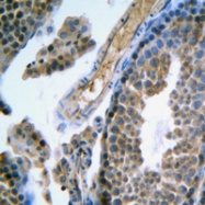 CPA1445-100ul - FSH Receptor