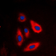 CPA1459-100ul - Galactokinase 1