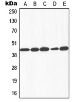 CPA1459-100ul - Galactokinase 1