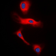 CPA1464-100ul - Glucagon