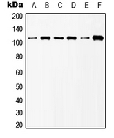 CPA1507-100ul - mGluR6 / GRM6