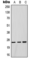CPA1514-100ul - GSTM1