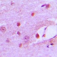 CPA1516-100ul - MSH6
