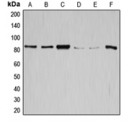 CPA1521-100ul - Glycogen Synthase
